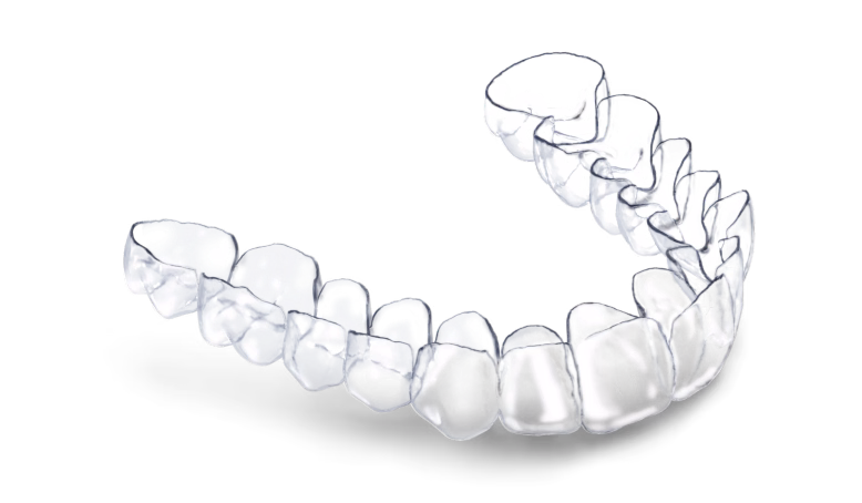 Estos son los alineadores invisibles, un moderno sistema de ortodoncia.